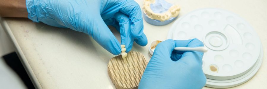 kronen en bruggen behandeling