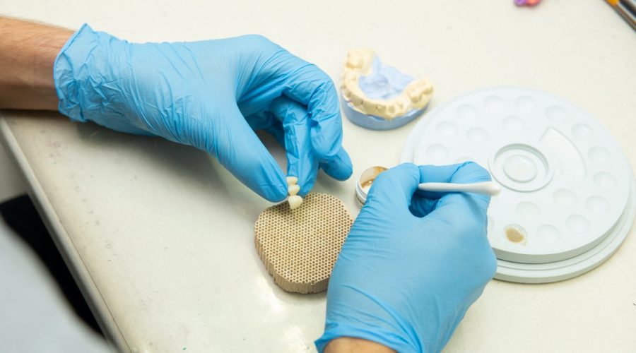 kronen en bruggen behandeling