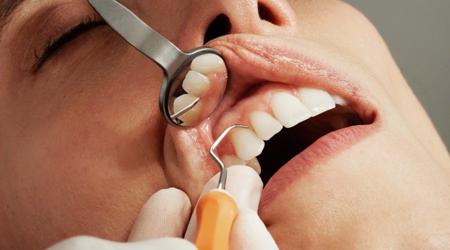 tandvleesontsteking-unsplash