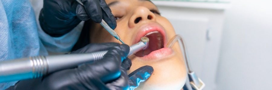 wortelkanaal behandelingen